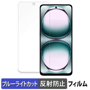 UMIDIGI Note 100 یtB u[CgJbg tB y ˒ጸ z {