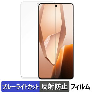 OnePlus 13R یtB u[CgJbg tB y ˒ጸ z {