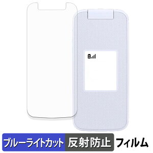 FCNT 炭炭z F-41F ( TufBXvC ) یtB u[CgJbg tB y ˒ጸ z {