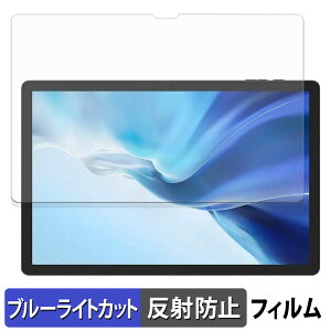 DOOGEE Tab E3 Pro یtB u[CgJbg tB y ˒ጸ z {