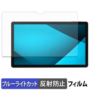 ACXI[} TM14D1M76-V1B یtB u[CgJbg tB y ˒ጸ z {