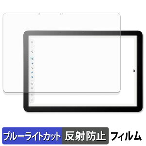 y|Cg2{z Wacom MovinkPad 11 یtB u[CgJbg tB y ˒ጸ z {
