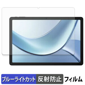 y|Cg2{z DOOGEE Tab E3 یtB u[CgJbg tB y ˒ጸ z {