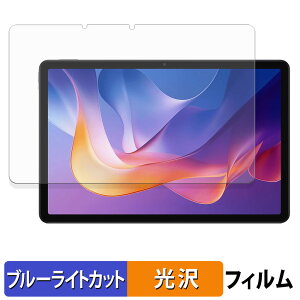 Xiaomi Redmi Pad 2 �ی�t�B���� �u���[���C�g�J�b�g �t�B���� �y ����d�l �z ���{��