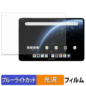 ALLDOCUBE Ultra Pad یtB u[CgJbg tB y dl z {