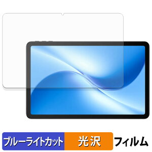 DOOGEE U12 یtB u[CgJbg tB y dl z {