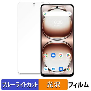 UMIDIGI Note 100A یtB u[CgJbg tB y dl z {