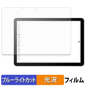 y|Cg2{z Wacom MovinkPad 11 یtB u[CgJbg tB y dl z {