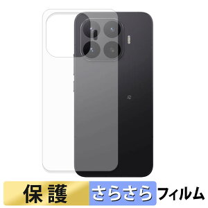 Xiaomi 17T Pro ( �w�� ) �X�L���V�[�� �y ���˒ጸ �z �ی�V�[�� ���{��