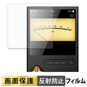 �y�|�C���g2�{�z ONIX Tocata XM2 �t�B���� �y ���˒ጸ �z �t�� �ی�t�B���� ���{��