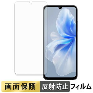 FOSSiBOT S2 �t�B���� �y ���˒ጸ �z �t�� �ی�t�B���� ���{��