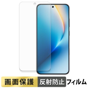 HONOR WIN / WIN RT �t�B���� �y ���˒ጸ �z �t�� �ی�t�B���� ���{��