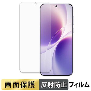 vivo X300s ������ �t�B���� �y ���˒ጸ �z �t�� �ی�t�B���� ���{��