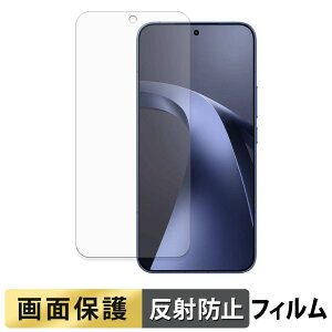 Xiaomi 17T Pro �t�B���� �y ���˒ጸ �z �t�� �ی�t�B���� ���{��