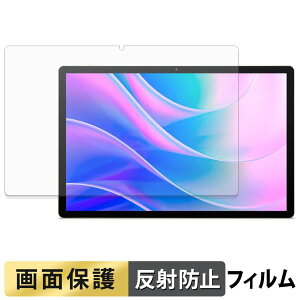 acer Iconia A14 �t�B���� �t�� �ی�t�B���� �y ���˒ጸ �z ���{��