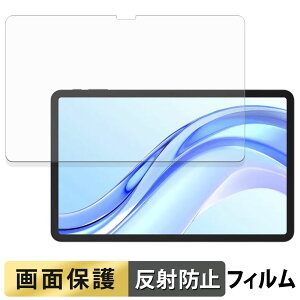 DOOGEE Tab E3+ �t�B���� �t�� �ی�t�B���� �y ���˒ጸ �z ���{��