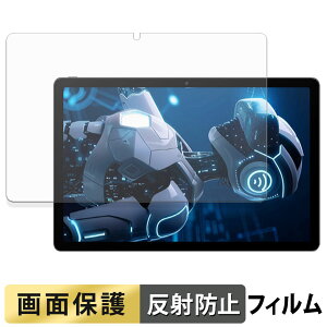 Tabtop A90PRO �t�B���� �t�� �ی�t�B���� �y ���˒ጸ �z ���{��