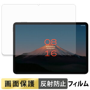 Xiaomi POCO Pad X1 �t�B���� �t�� �ی�t�B���� �y ���˒ጸ �z ���{��