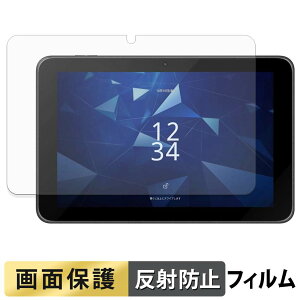 ���Z�� KC-T308 �t�B���� �t�� �ی�t�B���� �y ���˒ጸ �z ���{��