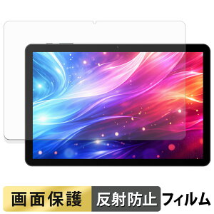 DOOGEE Tab G5 �t�B���� �t�� �ی�t�B���� �y ���˒ጸ �z ���{��