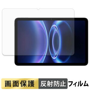 Xiaomi Redmi Pad 2 SE �t�B���� �t�� �ی�t�B���� �y ���˒ጸ �z ���{��
