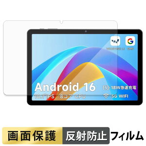 PHILIPS T7315X �t�B���� �t�� �ی�t�B���� �y ���˒ጸ �z ���{��