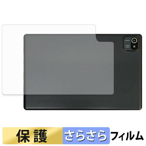 HiGrace MB1001 ( �w�� ) �X�L���V�[�� �y ���˒ጸ �z �ی�V�[�� ���{��