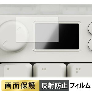Pulsar XPAD MINI Gaming Key Pad �t�B���� �y ���˒ጸ �z �t�� �ی�t�B���� ���{��