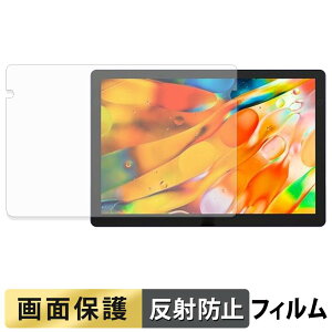 �y8/27 9:59�� �|�C���g2�{�z XP-Pen Artist Ultra 14 �t�B���� �t�� �ی�t�B���� �y ���˒ጸ �z ���{��