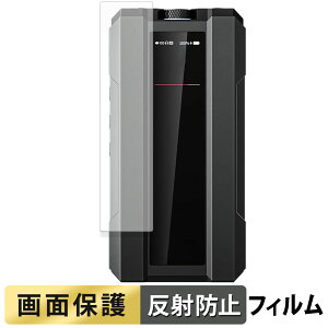 �y�|�C���g2�{�z FIIO Q15 �t�B���� �y ���˒ጸ �z �t�� �ی�t�B���� ���{��