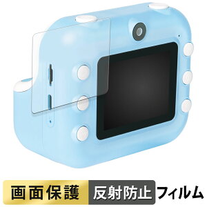 �A�K�c�} ���݂��R���炵 �v�����g�f�W�J�� �t�B���� �t�� �ی�t�B���� �y ���˒ጸ �z ���{��