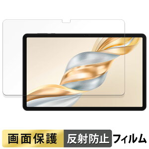 HONOR Pad X9 Pro / Pad X9a �t�B���� �t�� �ی�t�B���� �y ���˒ጸ �z ���{��