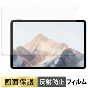 ZTE nubia Pad Pro �t�B���� �t�� �ی�t�B���� �y ���˒ጸ �z ���{��