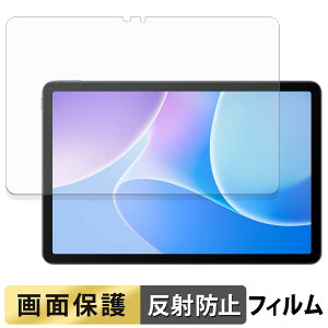 �y8/11 1:59�� �|�C���g2�{�z Infinix XPAD 20 �t�B���� �t�� �ی�t�B���� �y ���˒ጸ �z ���{��