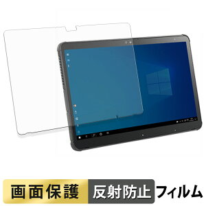 �x�m�� ARROWS Tab Q7311 �V���[�Y / Q7310 �V���[�Y �t�B���� �t�� �ی�t�B���� �y ���˒ጸ �z ���{��