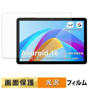 PHILIPS T7315X �t�B���� �t�� �ی�t�B���� �y �����ߗ� �z ���{��