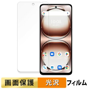 UMIDIGI Note 100A tB y ߗ z t یtB {