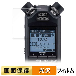 y|Cg2{z OM SYSTEM ICR[_[ LS-P5 tB y ߗ z t یtB {