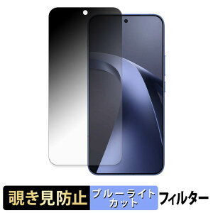 Xiaomi 17T Pro �y 180�x �z �`�����h�~ �t�B���� �u���[���C�g�J�b�g �A���`�O���A ���{��