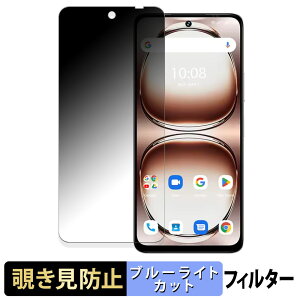 UMIDIGI Note 100A y 180x z `h~ tB u[CgJbg A`OA {