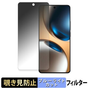 realme GT7 �y 180�x �z �`�����h�~ �t�B���� �u���[���C�g�J�b�g �A���`�O���A ���{��