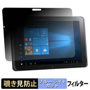 �x�m�� ARROWS Tab Q509 �V���[�Y �y 180�x �z �`�����h�~ �t�B���� �u���[���C�g�J�b�g �A���`�O���A ���{��