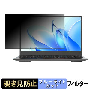 VETESA I7NQ716512GM �`�����h�~ �v���C�o�V�[�t�B���^�[ �y �^�u�E�S���V�[���� �z �u���[���C�g�J�b�g �ی�t�B���� ���˖h�~