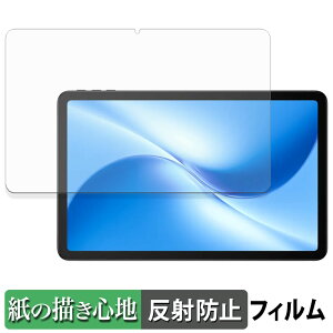 DOOGEE U12 y[p[CN tB y ̂悤ȏSn z t یtB ˒ጸ {