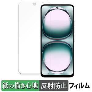 UMIDIGI Note 100 y[p[CN tB y ̂悤ȏSn z t یtB ˒ጸ {