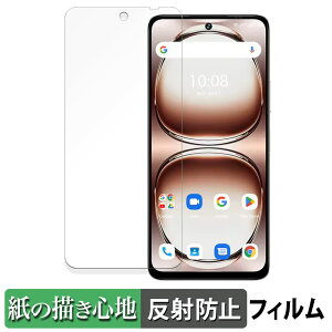 UMIDIGI Note 100A y[p[CN tB y ̂悤ȏSn z t یtB ˒ጸ {