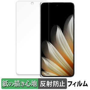 y|Cg2{z OPPO Find N5 ( TufBXvC ) y[p[CN tB y ̂悤ȏSn z t یtB ˒ጸ {