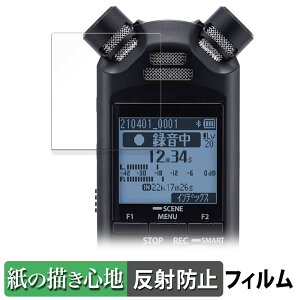 y|Cg2{z OM SYSTEM ICR[_[ LS-P5 y[p[CN tB y ̂悤ȏSn z t یtB ˒ጸ {