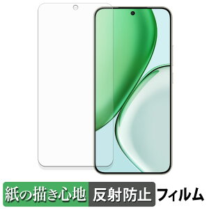 y|Cg2{z HONOR X70 y[p[CN tB y ̂悤ȏSn z t یtB ˒ጸ {