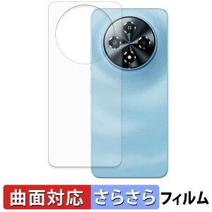 FOSSiBOT S5 / S5 Pro ( �w�� ) �X�L���V�[�� �y �ȖʑΉ� ���˒ጸ �z �ی�V�[�� �L�Y�C�� ���{��